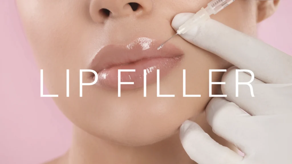 Woman receiving lip fillers