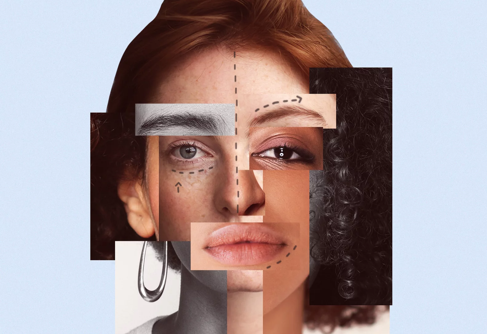 tmp_L7Hrxk_36bd933e6f7c3f28_Main_PS24_03_Beauty_BotchedSurgeries_1456x1000